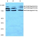 p-PAK4/5/6 (S474) pAb