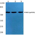 p-PAK2 (S20) pAb