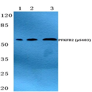 p-PFKFB2 (S483) pAb