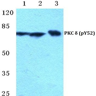 p-PKC (delta) (Y52) pAb