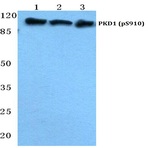 p-PKD1 (S910) pAb