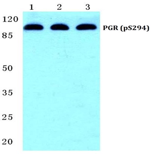 p-PR/PGR (S294) pAb