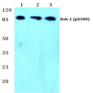 p-Rsk-1 (S380) pAb