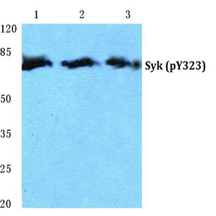 p-Syk (Y323) pAb