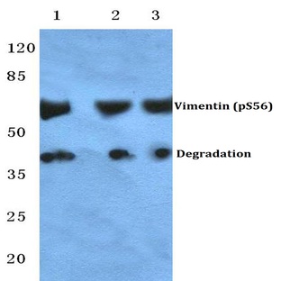 p-Vimentin (S56) pAb