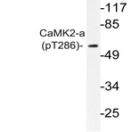 p-CaMKII(alpha) (T286) pAb