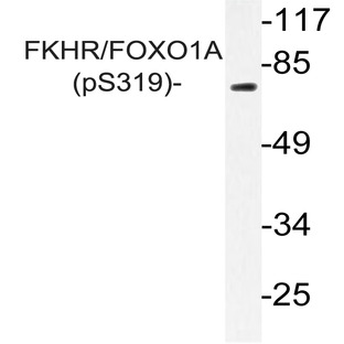 p-FKHR/FOXO1A (S319) pAb