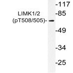 p-LIMK1/2 (T508/505) pAb