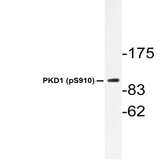 p-PKD1 (S910) pAb