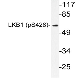 p-LKB1 (S428) pAb