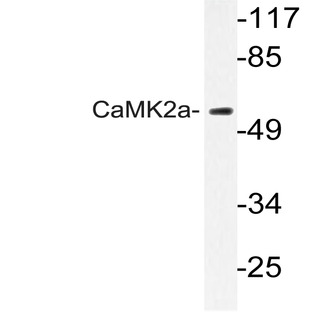 CaMKII(alpha) (K292) pAb