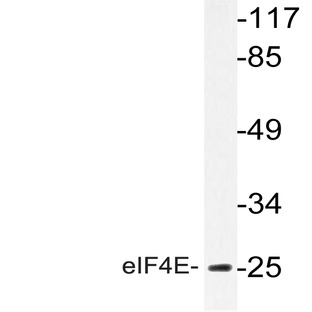 eIF4E (R215) pAb