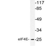 eIF4E (R215) pAb