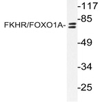 FKHR/FOXO1A (S262) pAb