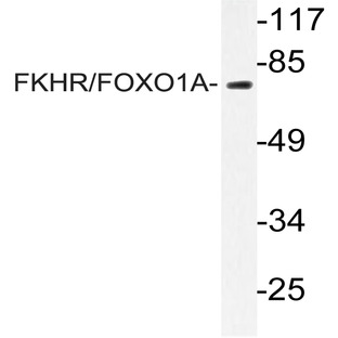 FKHR/FoxO1 (I325) pAb