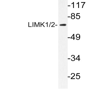 LIMK1/2 (P514) pAb