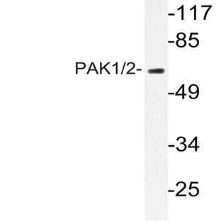 PAK1/2 (P429) pAb