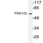 PAK1/2 (P429) pAb