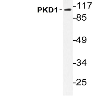 PKD1 (V744) pAb