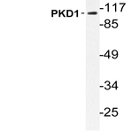 PKD1 (L916) pAb