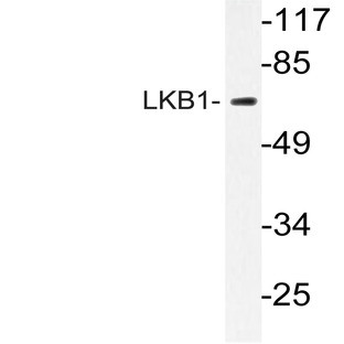 LKB1 (P340) pAb