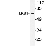 LKB1 (P340) pAb