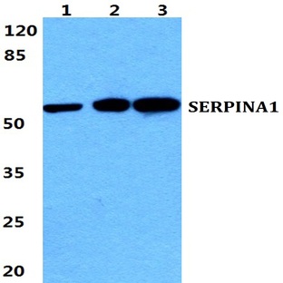 SERPINA1 pAb