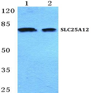 SLC25A12 pAb