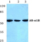 AR-(alpha)1B pAb