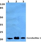 Cerebellin 1 pAb