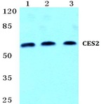 Bs5659_wb