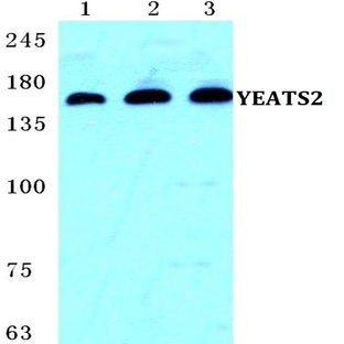 YEATS2 pAb