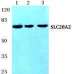 SLC28A2 pAb