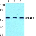 CYP2D6 (R450) pAb