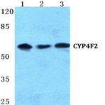 CYP4F2 pAb