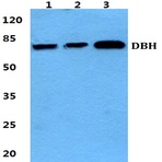 Bs5695_wb