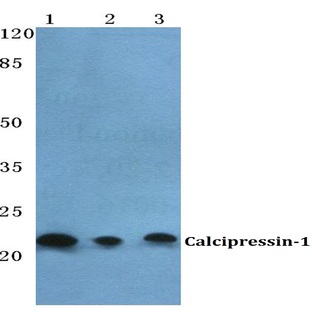 Calcipressin-1 pAb