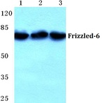 Frizzled-6 (G169) pAb