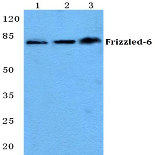 Frizzled-6 (T167) pAb