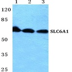 SLC6A1 pAb