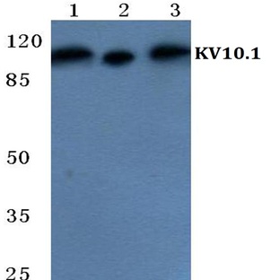 KV10.1 pAb