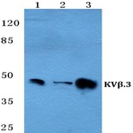 KV(beta).3 pAb