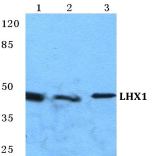 LHX1 pAb