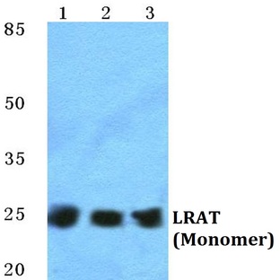 LRAT pAb