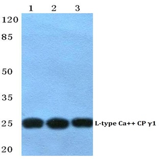CACNG1 pAb