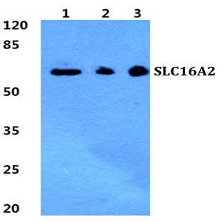 SLC16A2 pAb