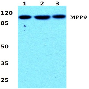 MPP9 pAb