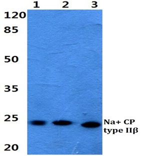 Na+ CP type II(beta) pAb