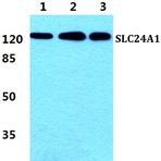 Bs5815_wb