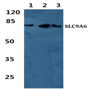 SLC9A6 pAb